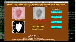 Skin Disease Detection Using CNN | Python OpenCV Keras Project Source Code