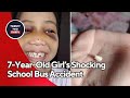 7-Year-Old Girl’s Shocking School Bus Accident: How Safe Are Our Children?