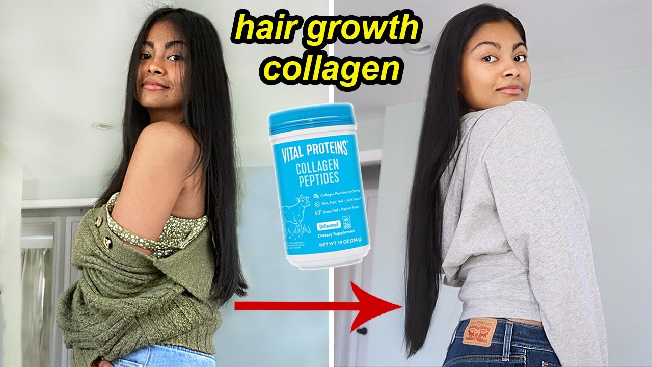 I Tried HAIR GROWTH COLLAGEN For 4 Months & THIS HAPPENED! | Before And ...