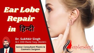 Ear Lobe Repair In Hindi | Torn Ear Lobe Repair | कान को आकार में रखें सर्जरी के माध्यम से