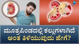 Kidney Stone | ಮೂತ್ರಪಿಂಡದ ಕಲ್ಲುಗಳನ್ನು ಹೊರದೂಡುವ ಸಲಹೆ