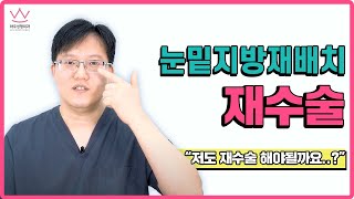 눈밑지방재배치 실패했다고??😢 재수술 잘 알아보고 결정하세요!!(feat.조종제)