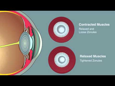 What happens when the eye accommodates to see a near object?