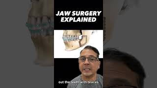 Orthognathic Jaw Surgery: Align Teeth \u0026 Facial Bones | In Office to Hands On Dental Training #shorts