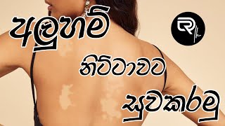 අලුහම් නිට්ටාවටම සුවකරමු | Tinea Versicolor | Pityriasis Versicolor | Medical Treatment | MedCentral