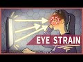 EYE STRAIN - Causes & Prevention || Dark Mode, Blue Light & more