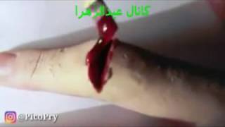 آموزش شعبده بازی قطع کردن انگشت دست .Learning magic is really very simple cut fingers