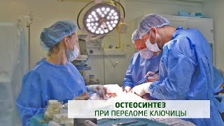 Остеосинтез при переломе ключицы