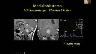 Neuroradiology of Medulloblastomas - Dr Suresh Mukherji MD MBA FACR \u0026 Dr Hemant Parmar MB BS