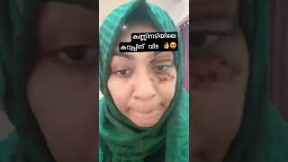 കണ്ണിനടിയിലെ കറുപ്പ് പെട്ടെന്ന് മാറ്റാം 😳👌how to remove eye dark circles😎#trending #eye #fashion