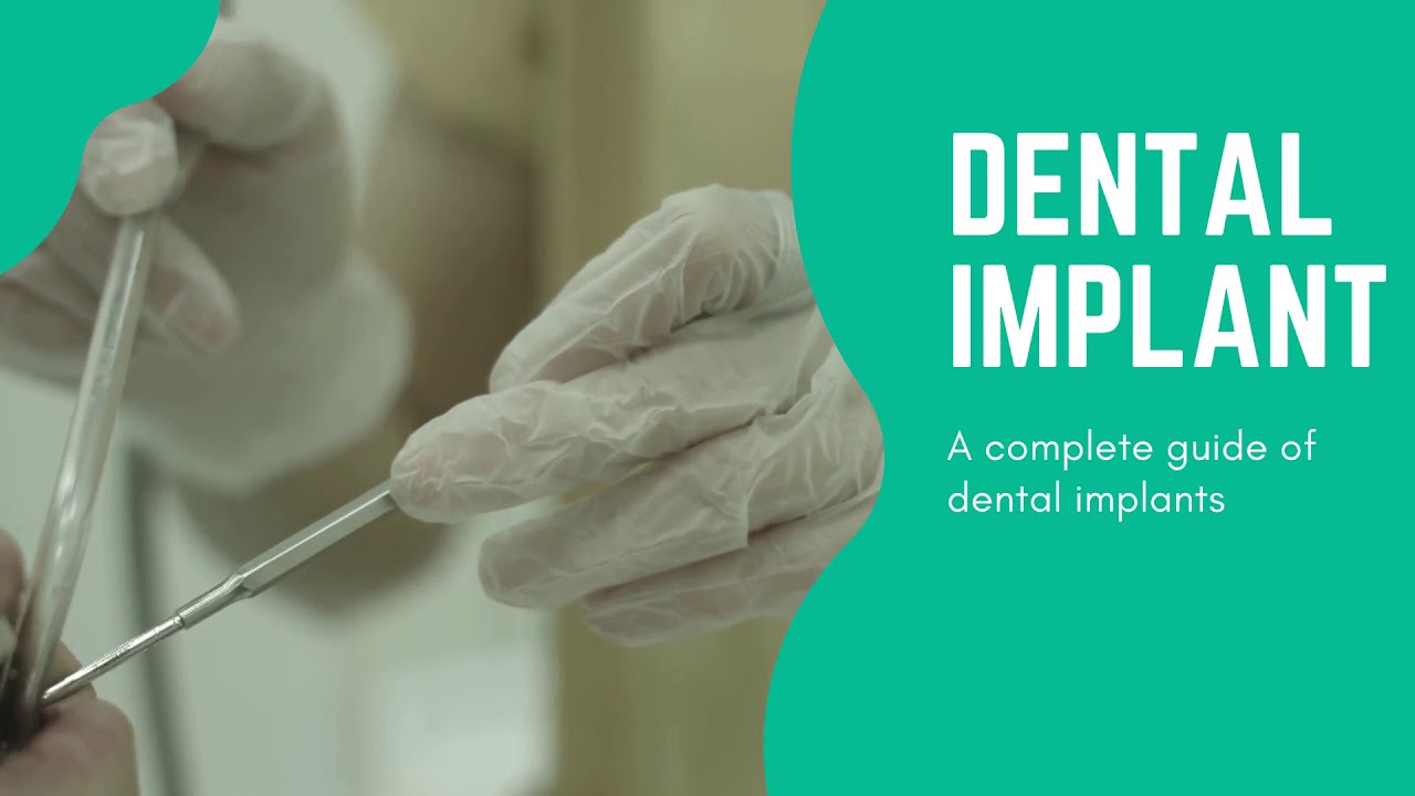 Dental Implant Youtube