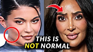 Kim and Kylie's Faces Keep Changing & Fans Are Worried | HIGHLIGHTS