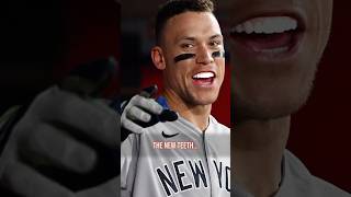 Is Aaron Judge the face of the baseball? #mlb