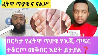 ❗ፈትዋ ክፍል/28/ የእጂ ጥፍር ቆርጦ መቅበር እደት ይታያል/ዲግምትን /በዲግምት ማሥፈታት❓