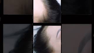 SCATTER scalp semipermanent