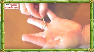 Cách tháo nhẫn bị chật dễ nhất!! How to Remove a Ring Stuck on Finger, Mẹo vặt hay| Bình Điên Nặng,