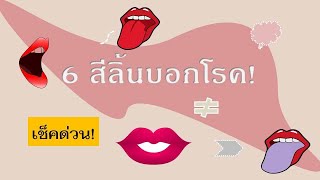 เช็คด่วน! 6 สีลิ้นบอกโรค / ippสาระดีดี