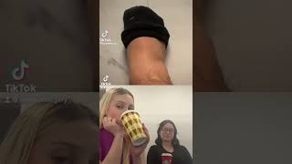 Bunion Correctors Don T Work Shorts Bunioncorrectors