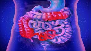 Intestinal Obstruction Rife Healing Frequency |Pure Isochronic Binaural Beats Music | Rife Treatment