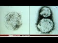 ஹான்டா வைரஸால் சீனாவில் ஒருவர் மரணம் what is hanta virus