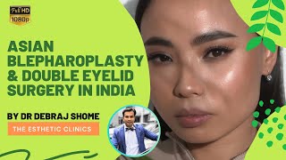 Asian Blepharoplasty & Double Eyelid Surgery to Create Aesthetic Eyelids in Hooded Monolid Eyes