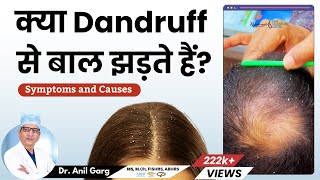 Does Dandruff Cause Hair Loss? | Treatment and Symptoms | क्या डैंड्रफ के कारण बाल झड़ते हैं?