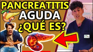 QUÉ ES PANCREATITIS AGUDA, CAUSAS | GuiaMed