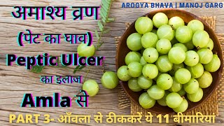 अमाश्य व्रण, पेट का घाव कारण, लक्षण, निदान, आंवला उपचार | Peptic Ulcer Ayurvedic Treatment Hindi