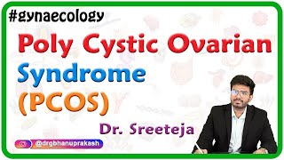 Poly Cystic Ovarian Syndrome (PCOS) / Stein–Leventhal syndrome / Hyperandrogenic anovulation