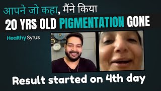 आपने जो कहा, मैंने किया I 20 years old Pigmentation gone. Result started from 4th day