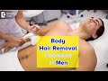 BODY HAIR REMOVAL FOR MEN. How is it done in a Skin Clinic? - Dr. Rajdeep Mysore | Doctors' Circle