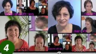 מילוי שיער דליל לגברים לנשים בירושלים בחיפה בתל אביב
