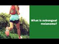 What is subungual melanoma?