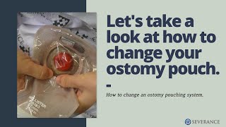 How to change an ostomy pouching system