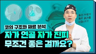 코 성형 재료에 따라 목적도 달라집니다! 비중격연골, 늑연골, 귀연골을 가장 잘 사용하는 방법은? (ft. 마인드성형외과 - 이강우 원장님)