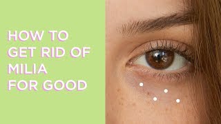 How to Get Rid of Milia | Glow Recipe