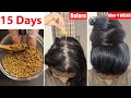 I apply just 4 Drops👆🏼 of this on bald scalp for 15 Days and Got Extreme Hair Growth