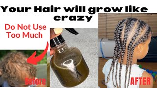 Your hair wouldn’t stop Growing! Use Twice A Week only For Shocking Results| Overnight Hair Spray…