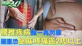 腰椎疾病釀一再閃腰 嚴重恐腿麻.疼痛逾2周以上 健康2.0 @tvbshealth20