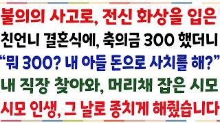 (반전신청사연)불의의 사고로 전신화상 입은 친 언니 결혼식에 축의금 300했더니 \