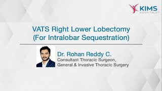 Advancing Lung Surgery: Benefits of VATS (Video-assisted Thoracic Surgery) for Lung Resection