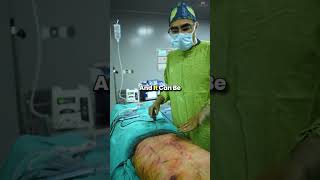 Reason for Ultrasonic Liposuction | Most Advanced Liposuction Surgery for Safe \u0026 Fast Recovery