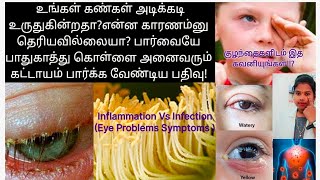 நம் கண் பார்வையே பாதிக்கும்  9 அறிகுறிகள் | Eye Problems Symptoms In Tamil | Eye Irritation 9 Causes