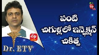 పంటి చిగుళ్లలో ఇన్ఫెక్షన్-చికిత్స | డాక్టర్ ఈటీవీ  | 20th అక్టోబర్ 2021| ఈటీవీ  లైఫ్