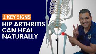 2 Key Signs It Is Possible For Hip Arthritis To Heal Naturally