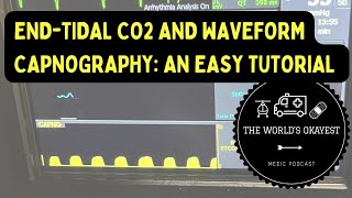 End-Tidal CO2 and Waveform Capnography: An Easy Tutorial (Explicit)