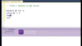 SQL server Star Pattern