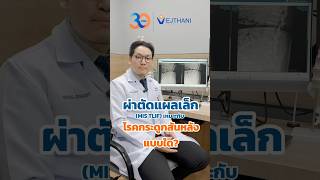 🩻#ผ่าตัดแผลเล็ก (MIS TLIF) เหมาะกับ #โรคกระดูกสันหลัง แบบได้?🧐 #กระดูกสันหลัง