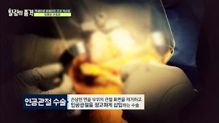 걸리면 완치 불가능 한 '퇴행성 관절염'의 위험성! 힐링의 품격 26회