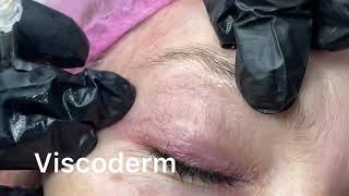 Viscoderm